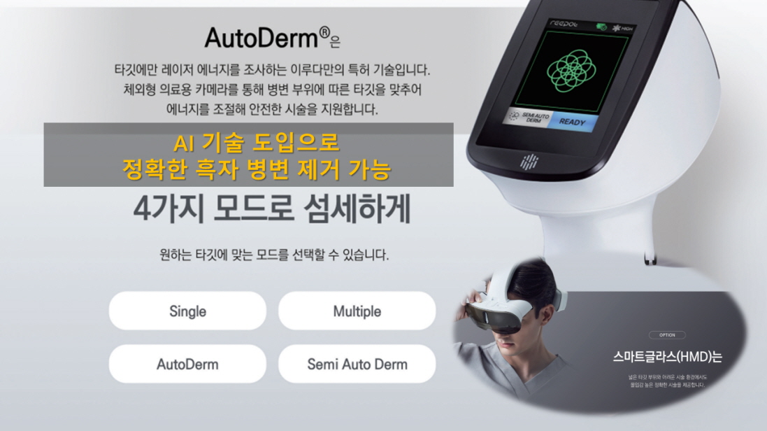 신개념 AI 흑자, 검버섯 치료 리팟 레이저 도입 - 피부칼럼 - 연세애드미피부과 - 깨끗하고 빛나는 피부를 드립니다. 피부과 ...